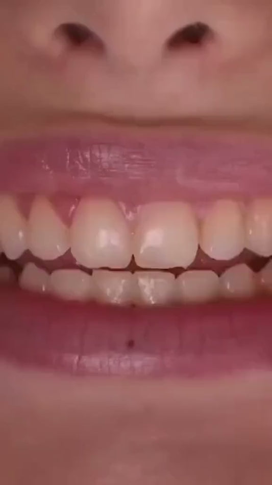 BLANQUEADOR DENTAL EN GEL